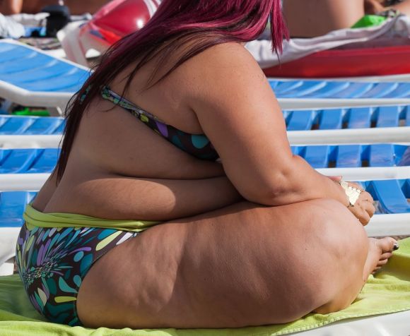 Ожирение: Жирная молодая женщина в бикини в баню для загорания.