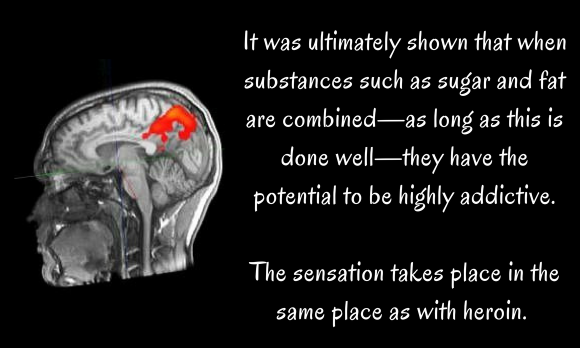 MRI: Magnetic Resonance Imaging scan of a head. MRI: Magnetic Resonance Imaging scan of a head.