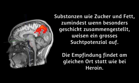MRI: Magnetresonanztomographie-Scan eines Kopfes. Text rechts als Collage. MRI: Magnetresonanztomographie-Scan eines Kopfes. Text rechts als Collage.