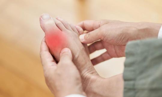 Viel tierisches Purin mit Gefahr zu Gicht oder Nierensteinen. Krankheit vermeiden oder mindern.