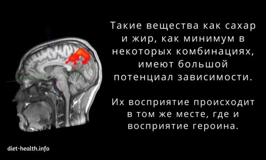 МРТ: магнитно-резонансная томография сканирования головы.